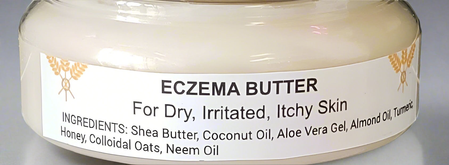 Eczema Butter Cream w/ Aloe Vera Gel All Natural
