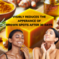 Turmeric Glow (Dark Spot Corrector) Soap
